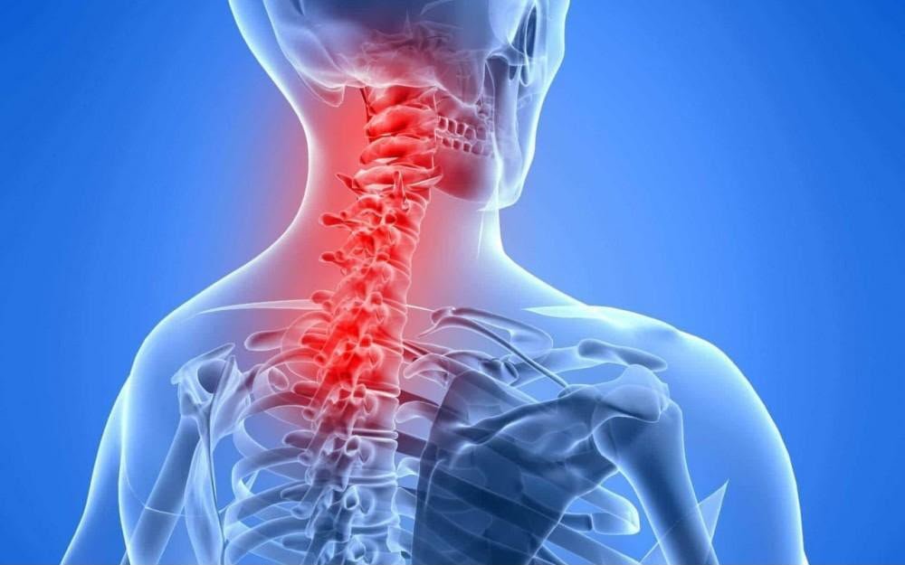 Neck Pain Pembrokeshire